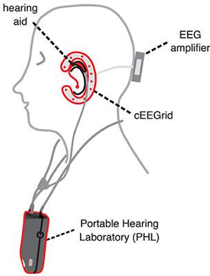 Synchronization of ear-EEG and audio streams in a portable research hearing device
